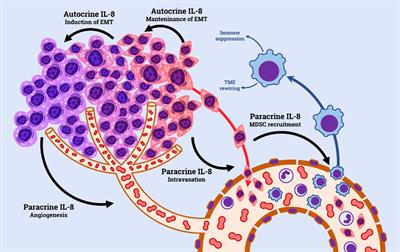 IL-8 and its role as a potential biomarker of resistance to anti-angiogenic agents and immune checkpoint inhibitors in metastatic renal cell carcinoma